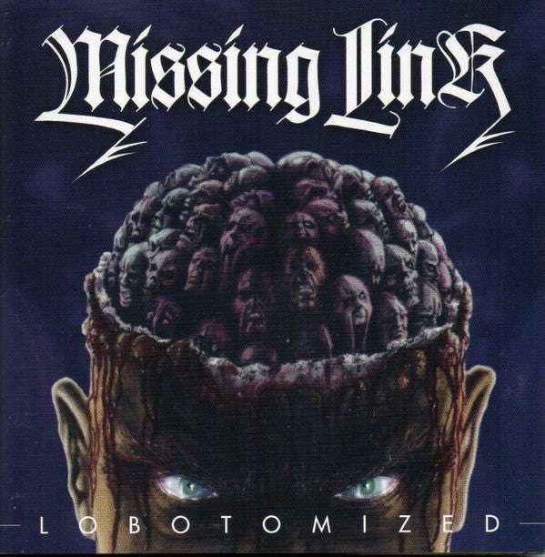 Missing Link (14) : Lobotomized (CD, Album, RE)