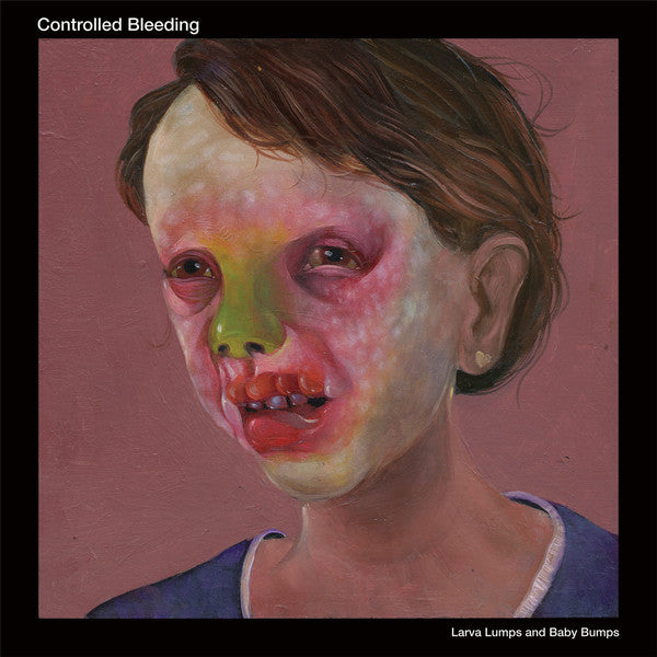 Controlled Bleeding : Larva Lumps And Baby Bumps (2xLP, Album, Swi)